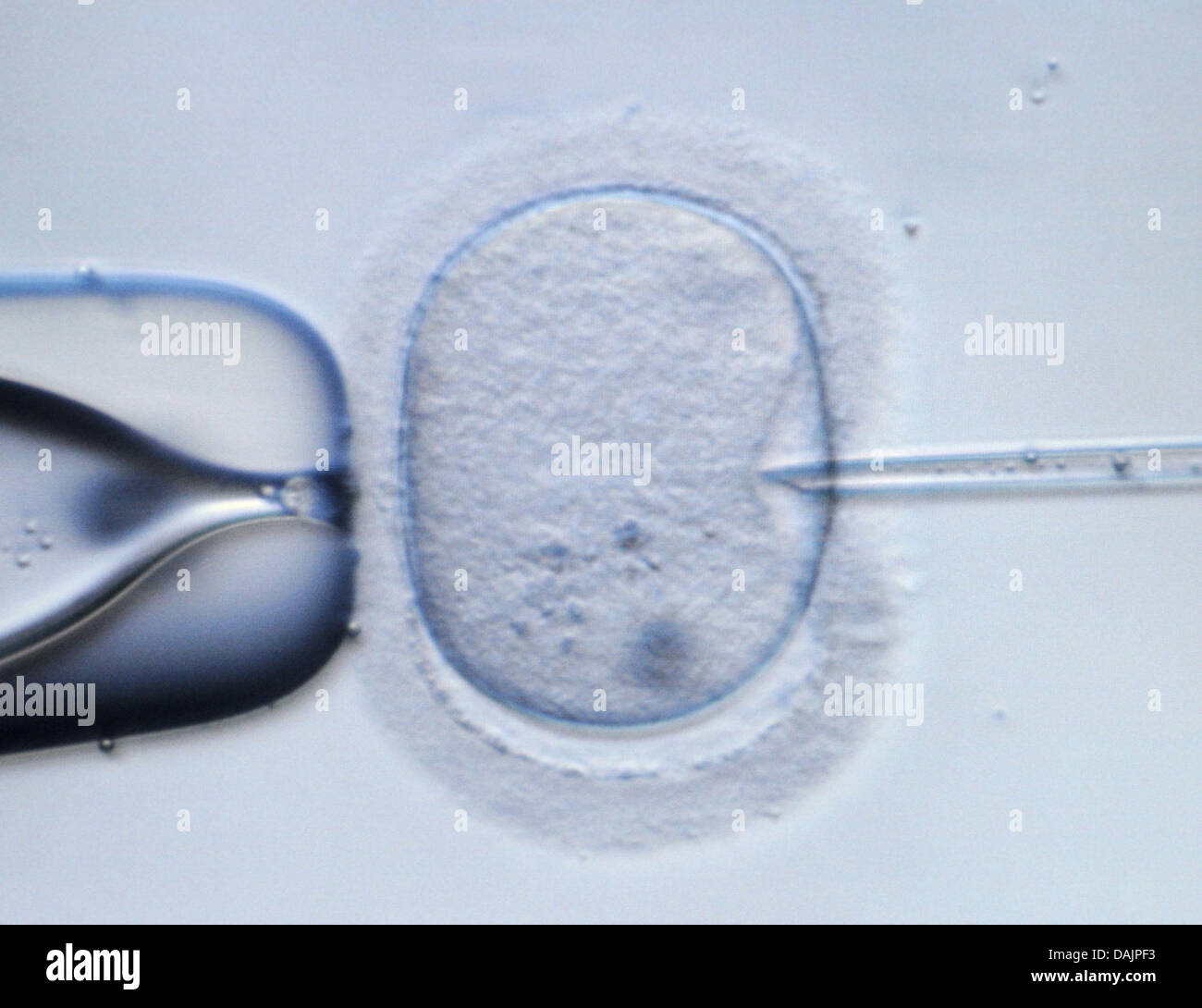 (Dossier) - Un fichier photo du DPA 09 février 2009 montre une image microscopique d'un ovule humain d'être percé par une aiguille d'injection dans un laboratoire à Dresde, Allemagne. Le diagnostic génétique préimplantatoire est un sujet controversé en Allemagne. Photo : Ralf Hirschberger Banque D'Images