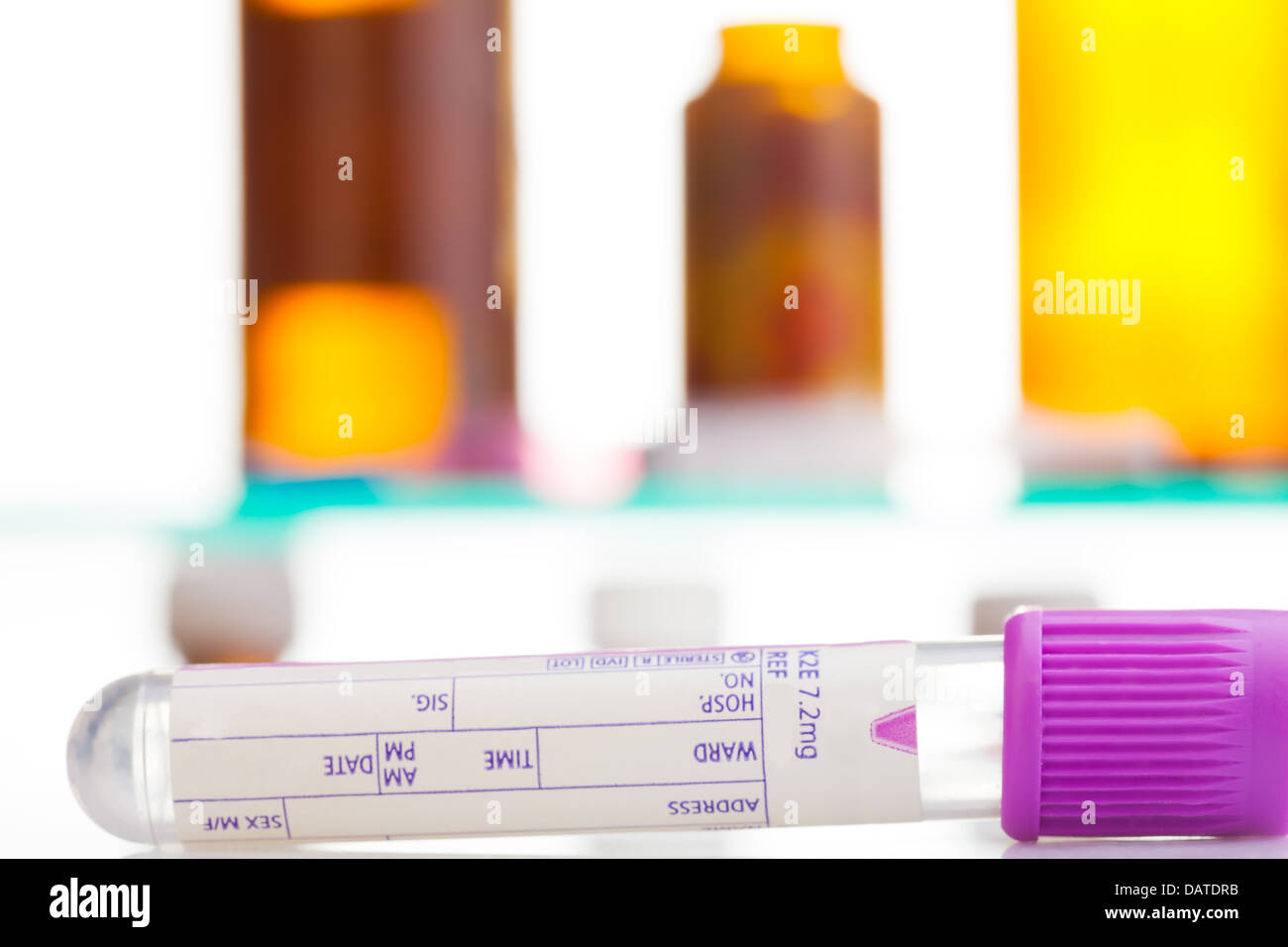 Close-up de l'échantillon de sang tube et tablette avec bols et d'autres médicaux sur l'arrière-plan Banque D'Images