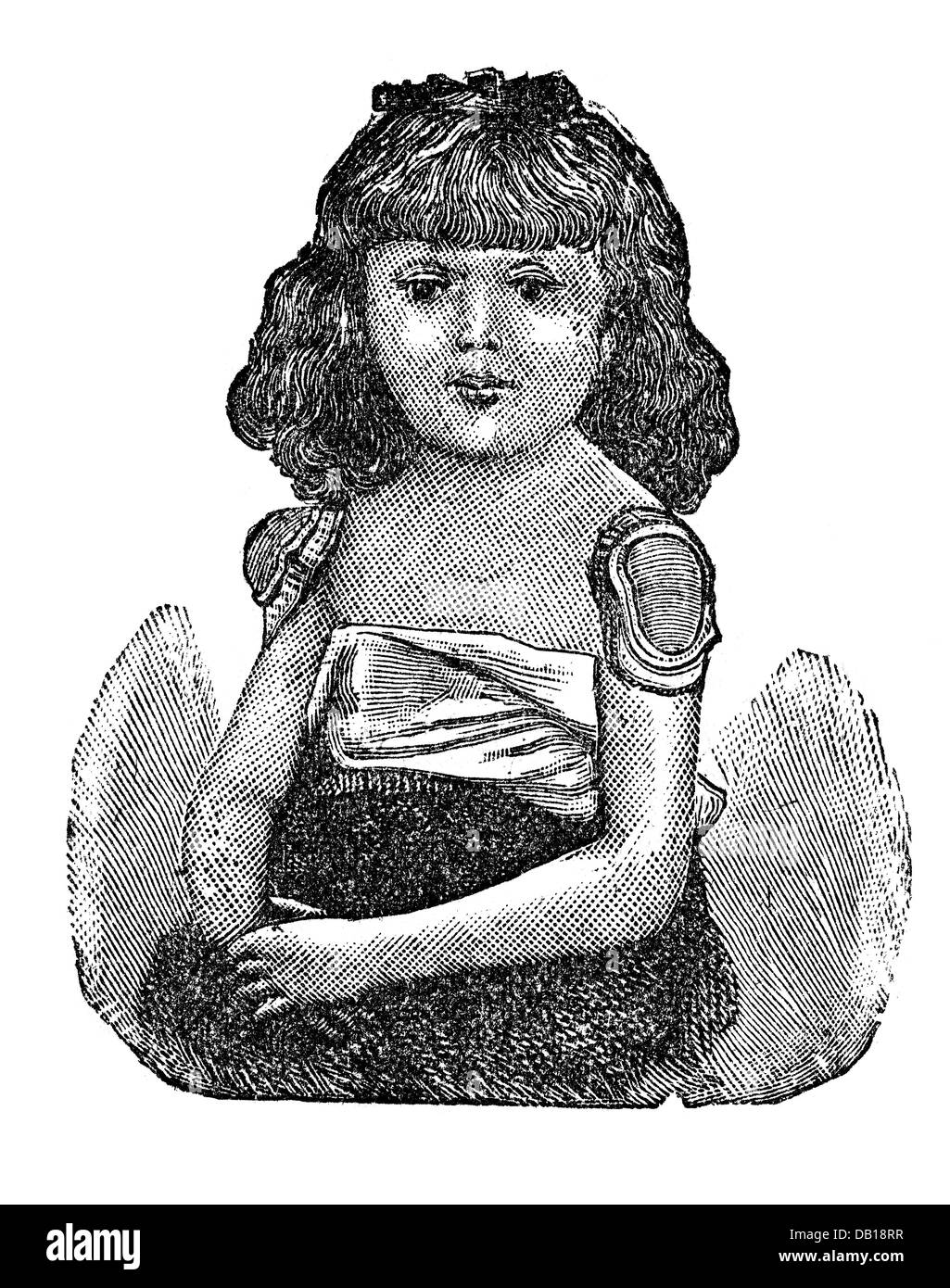 Médecine, vaccination, gardes pour la vaccination, gravure de bois, de: Friedrich Eduard Bilz, Nouveau traitement naturopathique, Leipzig, Allemagne, 1902, droits additionnels-Clearences-non disponible Banque D'Images