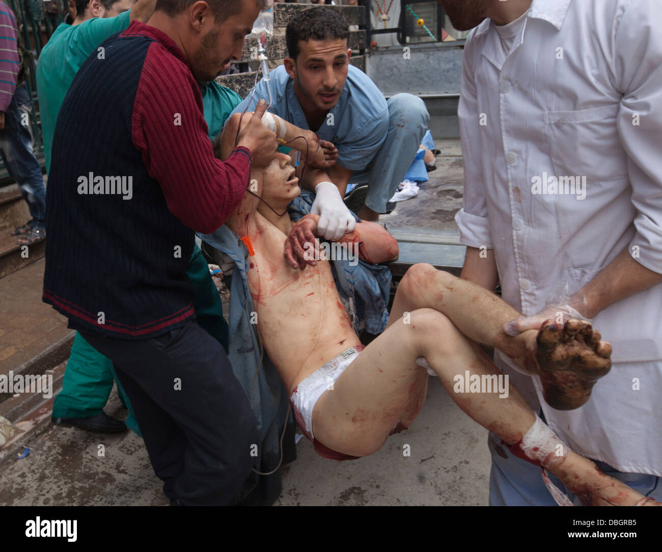 23 octobre 2012 - Alep, Syrie : un homme blessé est transporté dans un hôpital de première ligne. Banque D'Images