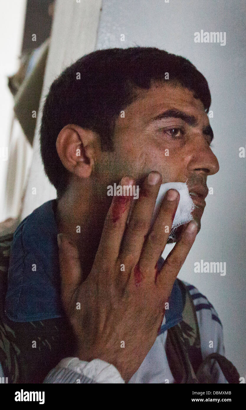 Une chasse de l'Armée syrienne libre est traité pour une blessure subie au cours de mortier près de la ligne de front dans la région de Safa. L'Eid Al Hada cesser Banque D'Images