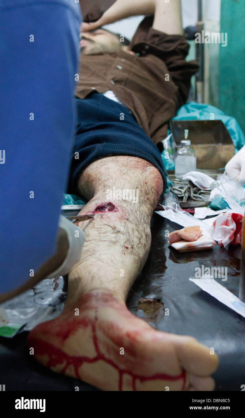 1 novembre 2012 - Alep, Syrie : un homme reçoit le traitement d'une blessure à un hôpital de première ligne. Banque D'Images