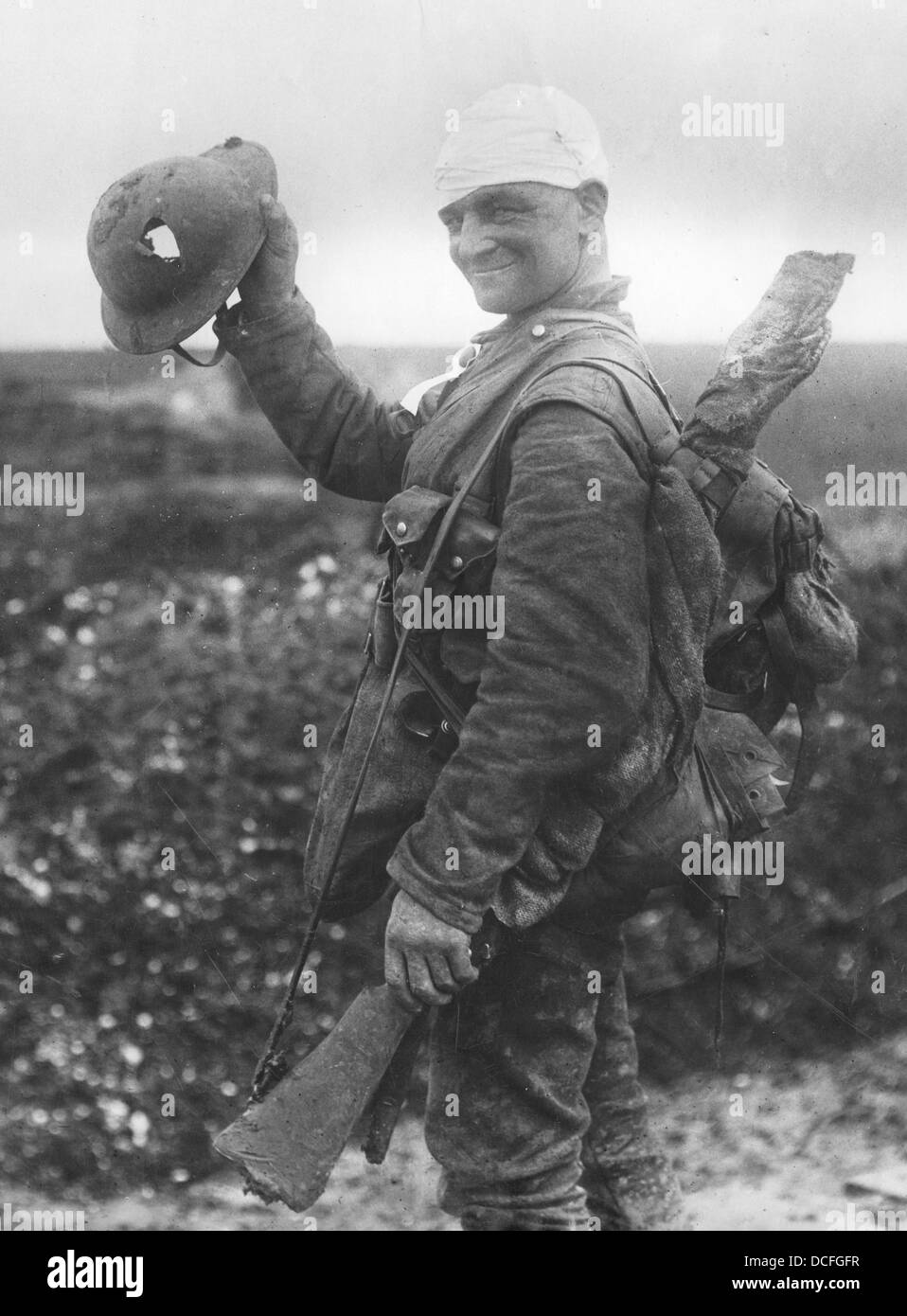Grande Guerre. WW1 un soldat britannique avec la tête bandée sur le chemin à l'arrière et de l'hôpital montre son casque d'acier endommagé par des éclats Banque D'Images