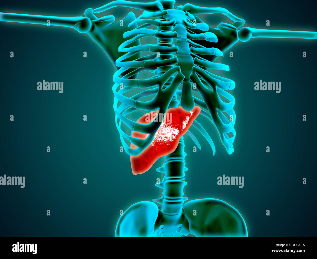 La vue X-ray de squelette humain avec le foie. Banque D'Images