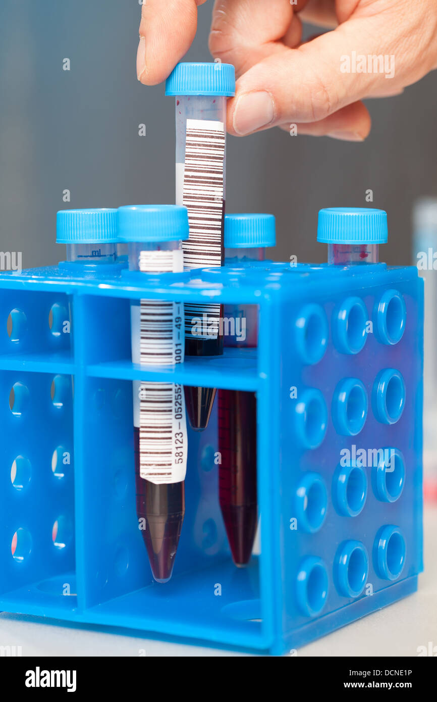 Du sang dans le tube pour analyse en laboratoire Banque D'Images