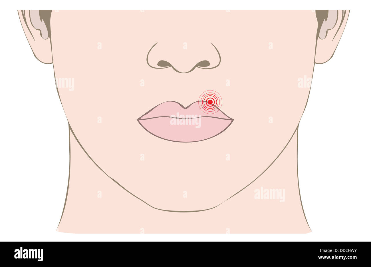 Condition Infectieuses Maladie infectieuse et condition humaine douloureuse Banque de ...