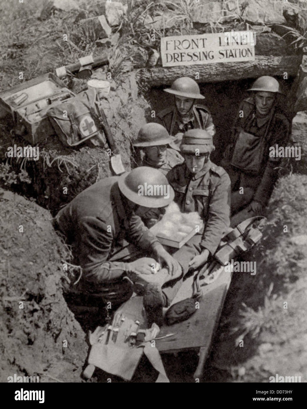 La WW1 soldat traité pour une blessure de la jambe à l'avant poste de secours en ligne. 1917. (BSLOC 2012 4 62) Banque D'Images