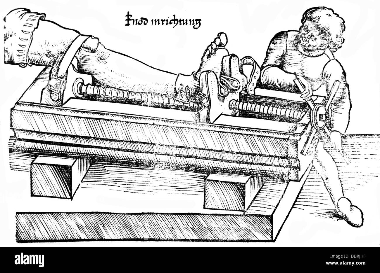 médecine, chirurgie, bras et jambes, traitement d'une blessure de genou avec une poulie, coupe de bois, xvie siècle, xvie siècle, graphique, graphique, subir une chirurgie, besoin de chirurgie, médecin, médic, médicaments, doc, médecins, docs, médecin, médecins, mi-longueur, debout, traitement, traitements, traiter, traitement, médecin, doctoring, jambe, jambes, appareils, instruments, dispositifs, instruments, dispositifs, dispositifs, instruments, instruments, dispositifs, instruments Poulie, poulies, étirement, étirement, médecine, médicaments, opération, opérations, bras, coupe de bois, coupe de bois, historique, historique, homme, hommes, homme, personnes, droits additionnels-Clearences-non disponible Banque D'Images
