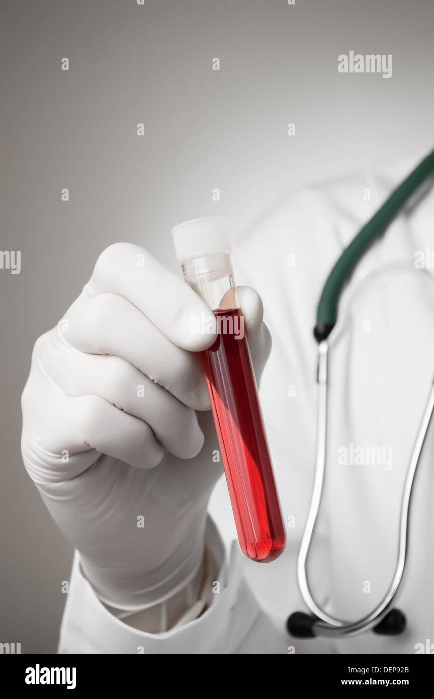 Main du médecin avec l'échantillon de sang Banque D'Images