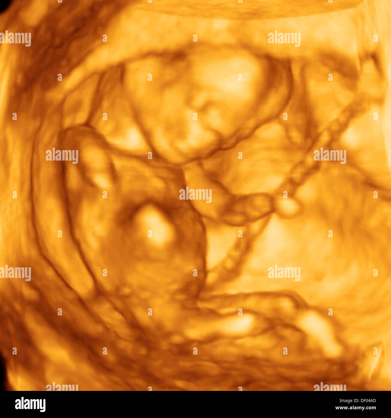 Echographie De Bebe A 5 Mois Photo Stock Alamy Echographie De Bebe A 5 Mois Photo Stock Alamy