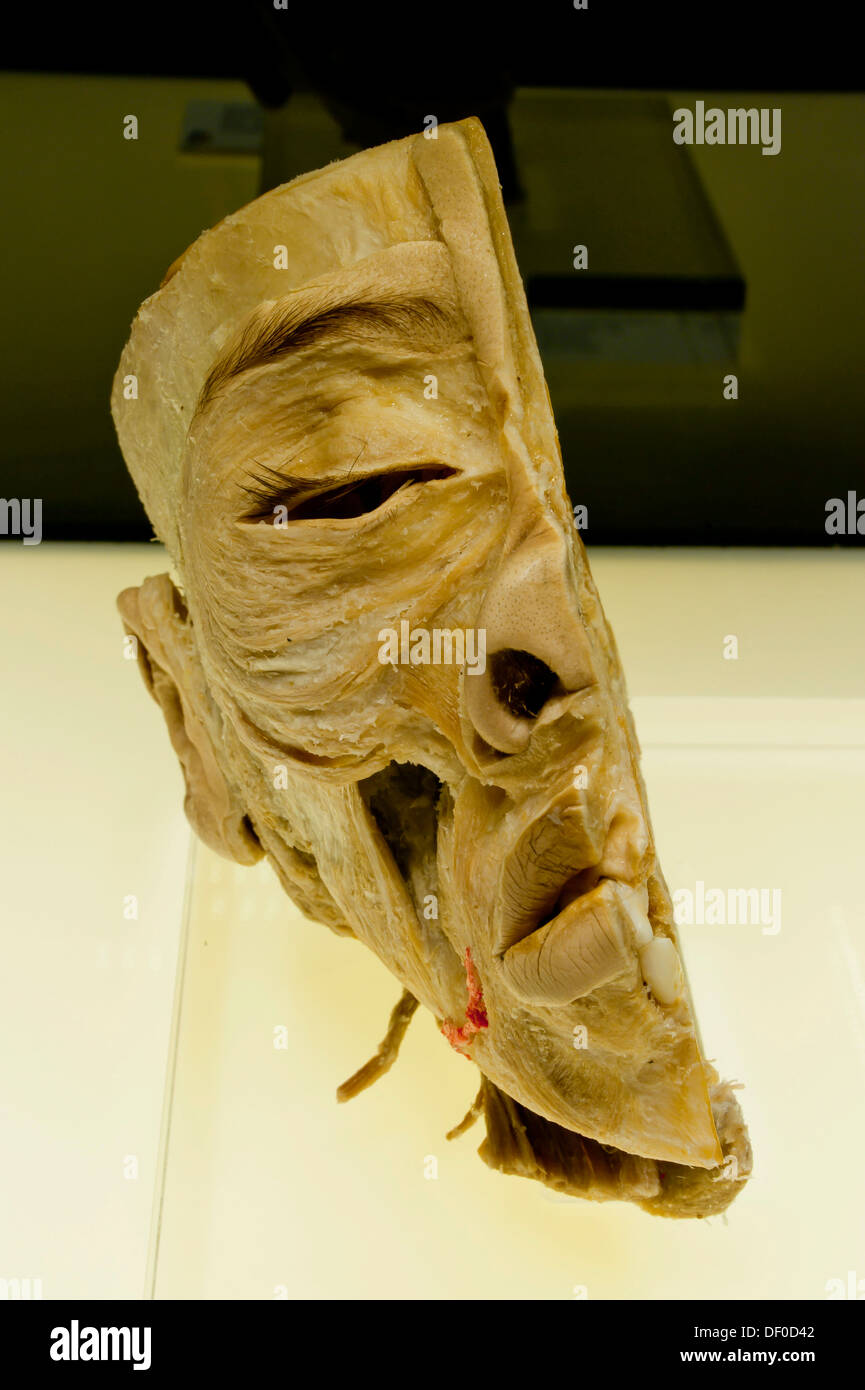 Spécimen de Plastination section sagittale de la tête montrant les muscles de l'expression du visage et les muscles impliqués dans la mastication Banque D'Images