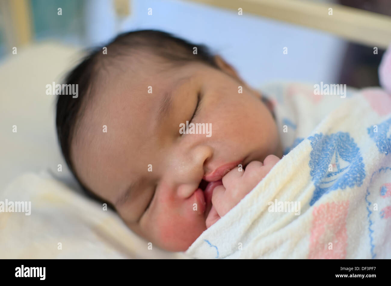 Nouveau Ne Avec Une Fente Labiale Et Palatine Dormir Photo Stock Alamy