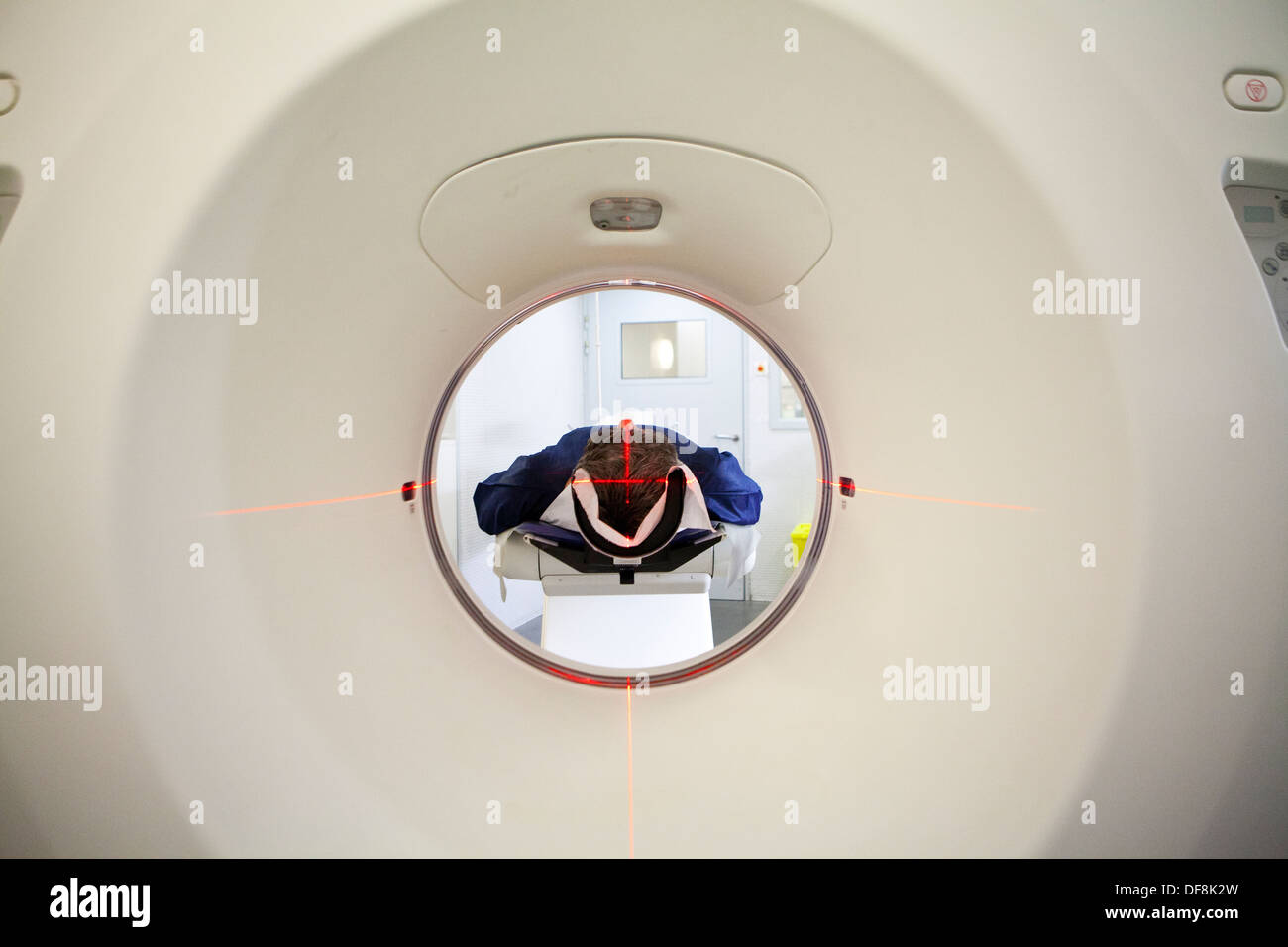 Crâne, EXAMEN CT SCAN Banque D'Images