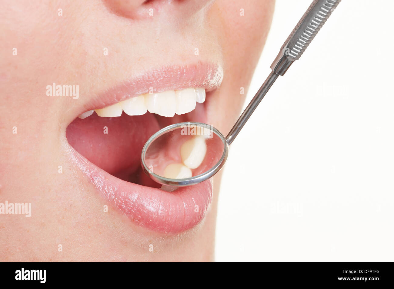 Femme au miroir de dentiste sur sa bouche ouverte Banque D'Images