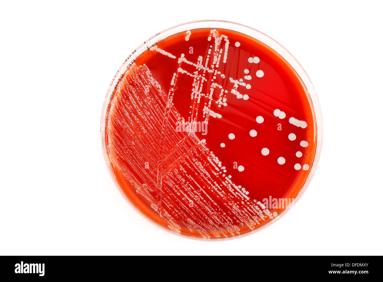 Boîte de pétri avec des bactéries rouge sur fond blanc Banque D'Images