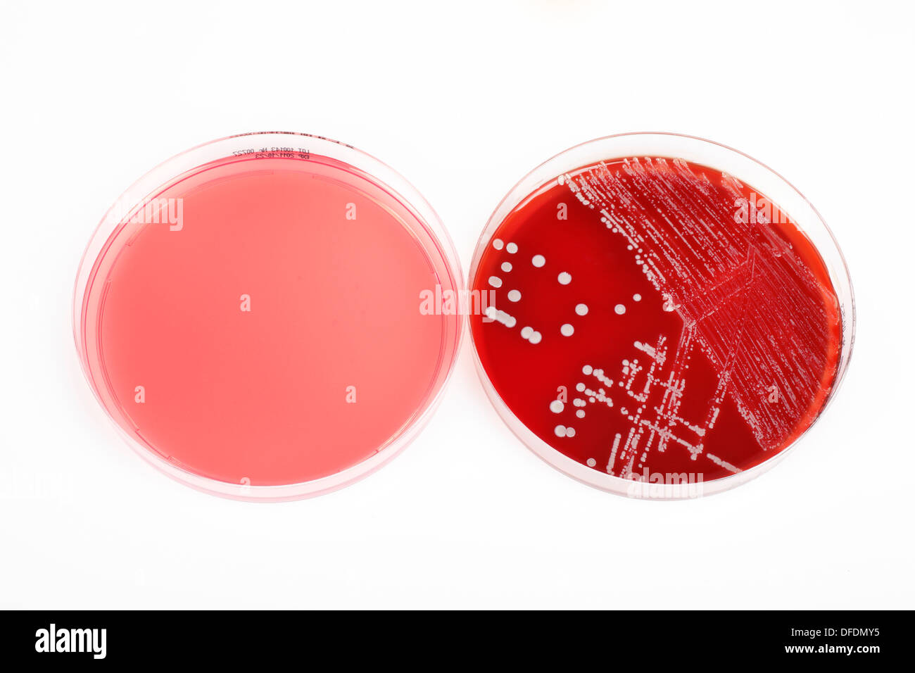 Deux dishs petri, un avec les bactéries et autres sans sur fond blanc Banque D'Images