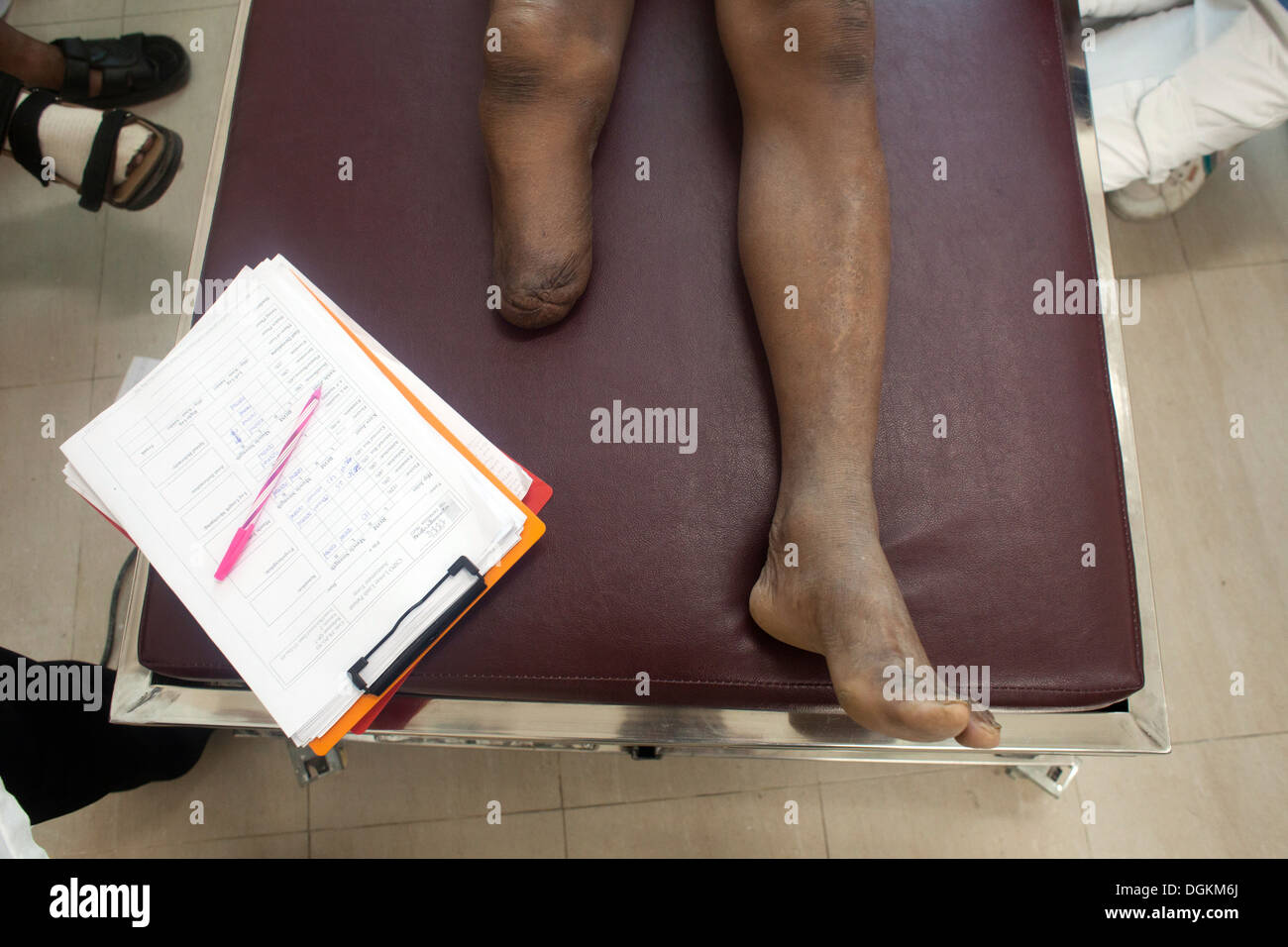 Cambodge phnom penh billet d'Asie du sud-est Asie image couleur landmine Cambodia Trust amputation amputé membre artificiel Banque D'Images