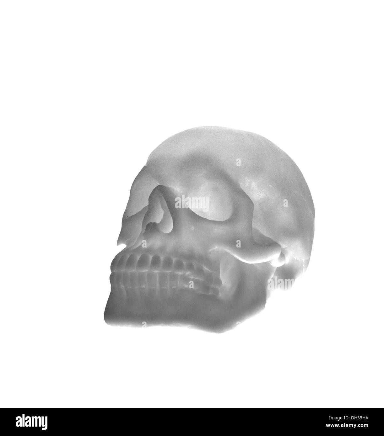 Les rayons de X-ray le crâne courts sur blanc, l'arrière-plan Banque D'Images