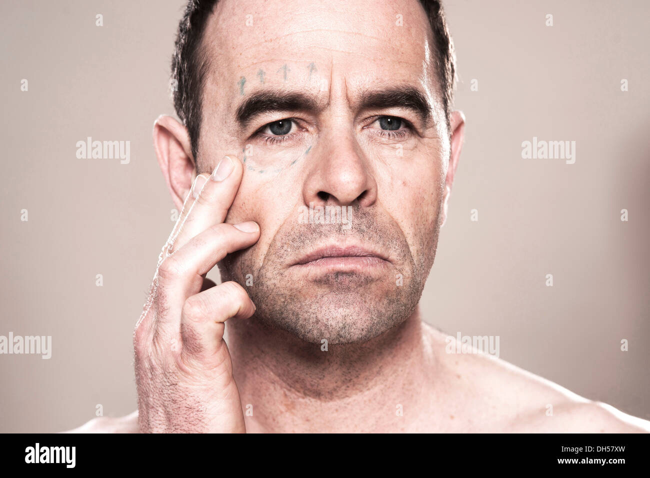 L'homme avec des marques pour la chirurgie en plastique sur son visage, Mannheim, Bade-Wurtemberg, Allemagne Banque D'Images