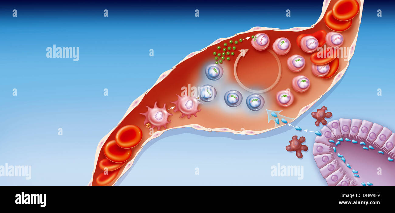 L'INFECTION PAR LE VIRUS DU SIDA, dessin Banque D'Images