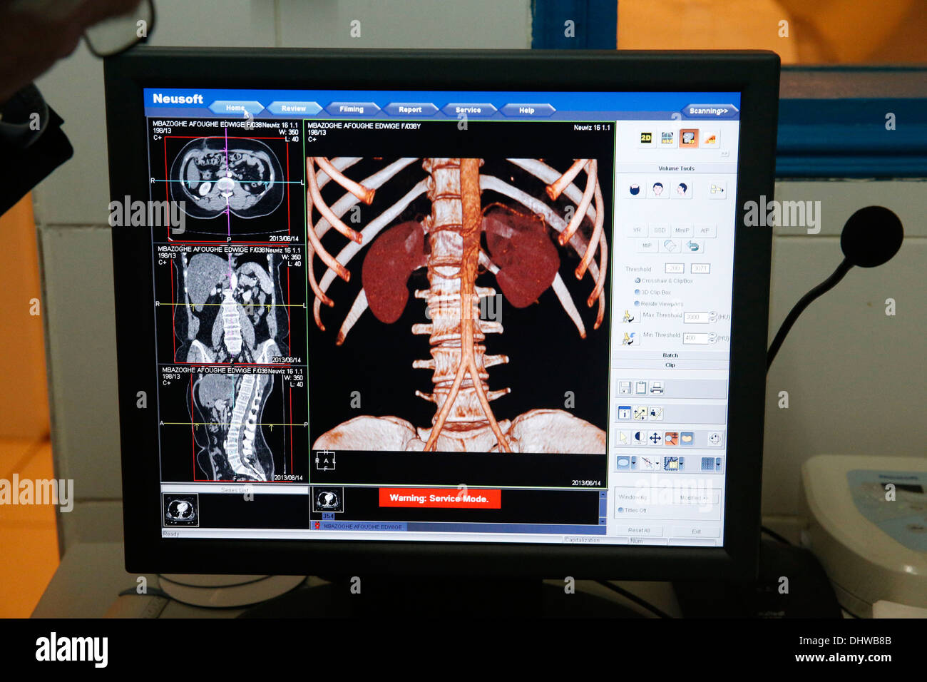 L'hôpital de Libreville. Examen médical. Banque D'Images
