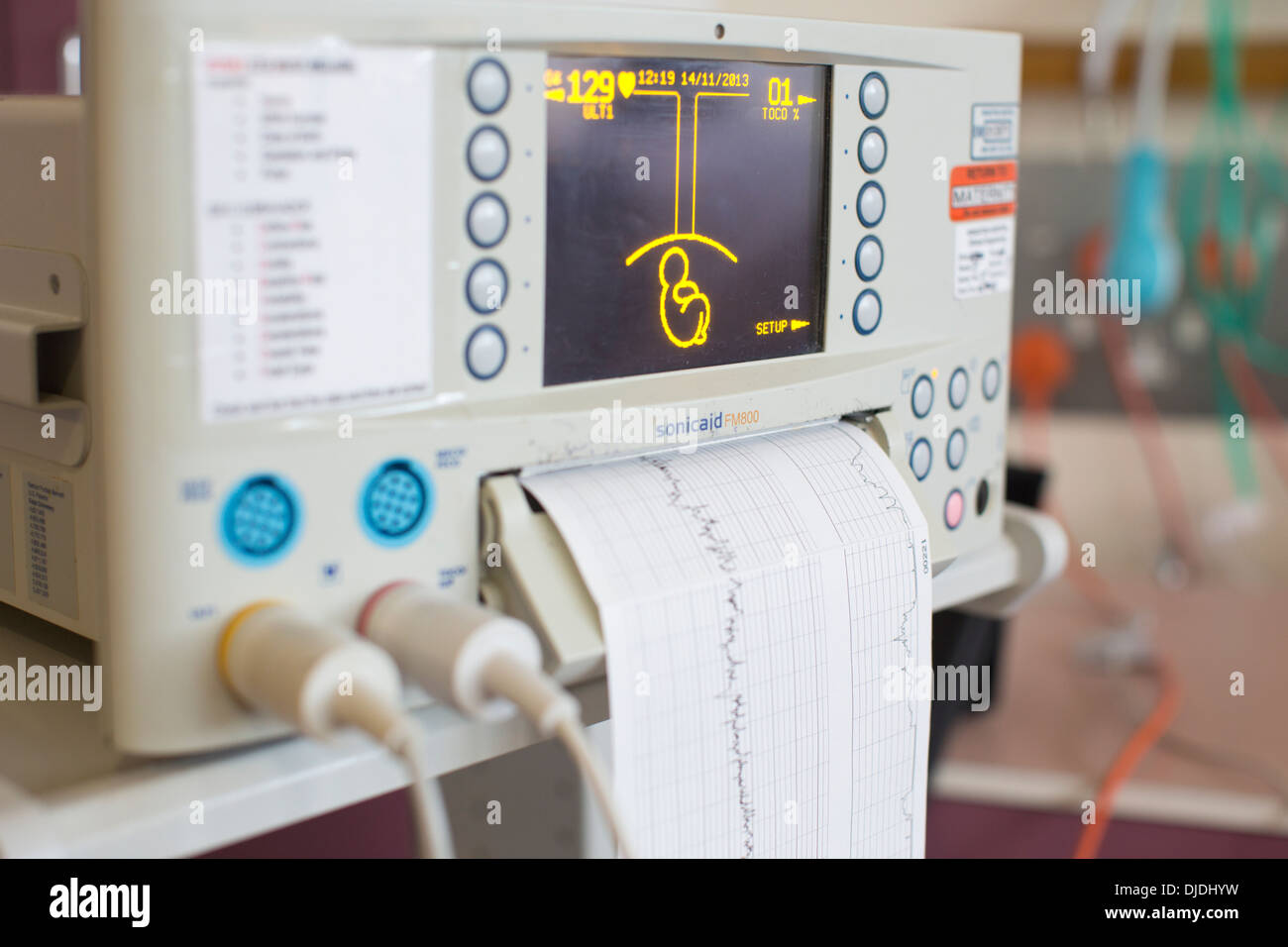La surveillance électronique du Fœtus, cardiotocography en maternité d'un hôpital, Kingston Upon Thames, Surrey, England, UK Banque D'Images