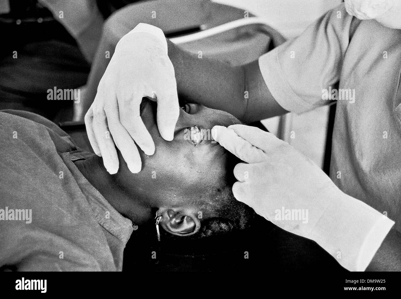 Mar 01, 1992 - Bo, Sierra Leone - Sight Savers charité travaillant sur l'oeil de la femme dans le village de Bo, en Sierra Leone. (Crédit Image : ©/ZUMAPRESS.com) Liasi Theodore Banque D'Images