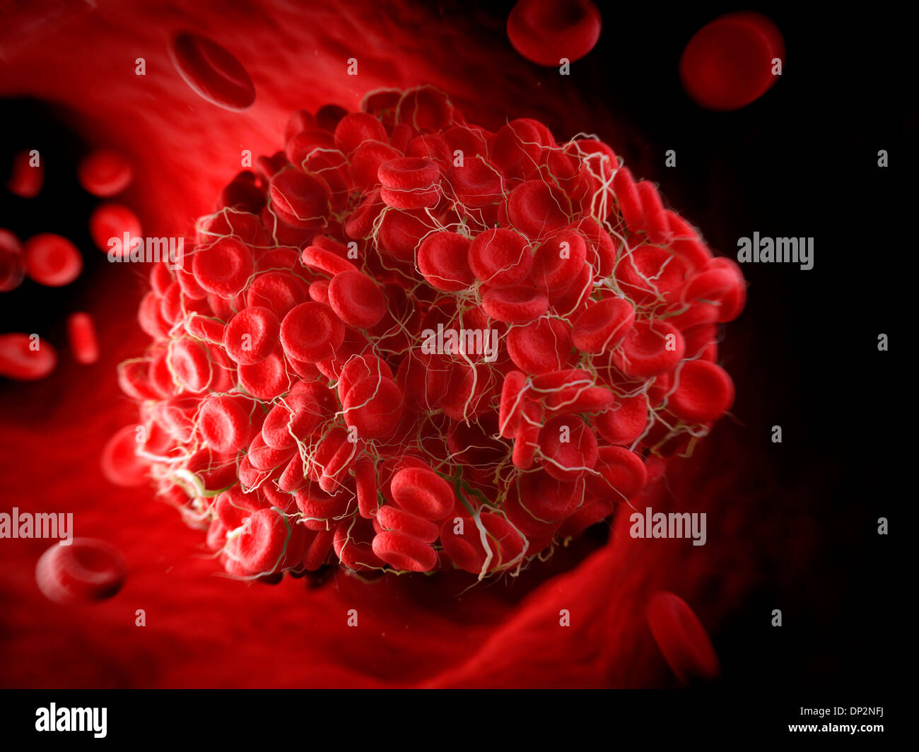 Caillot de sang, artwork Banque D'Images