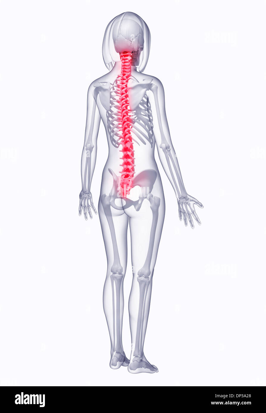 Back pain, artwork Banque D'Images