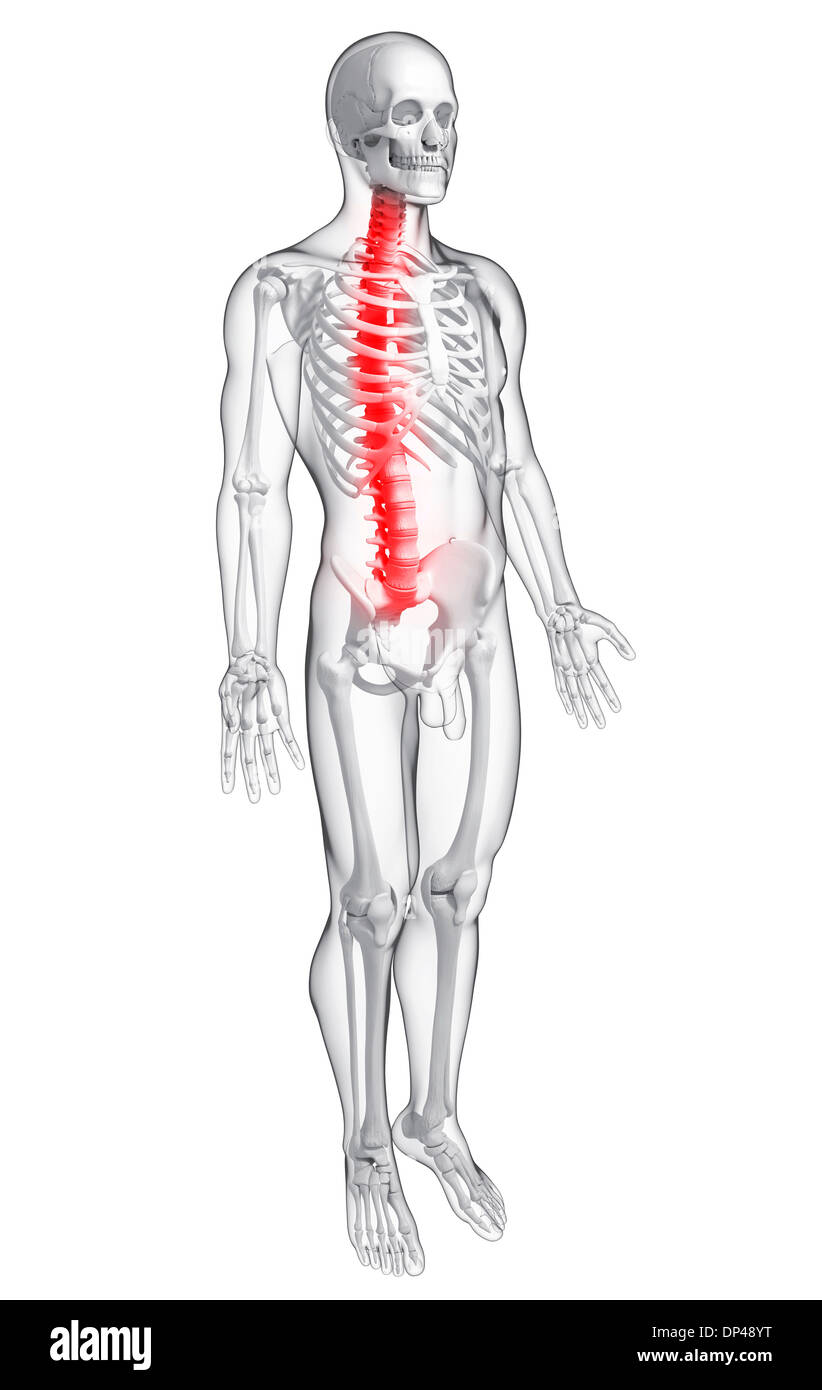 Back pain, artwork Banque D'Images