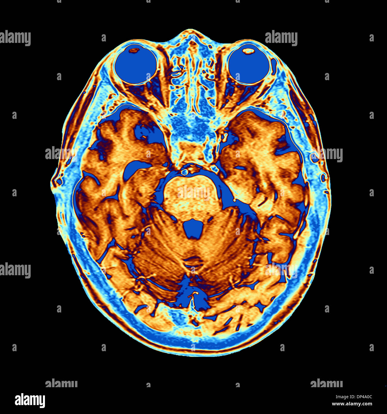 Irm de couleur de la tête humaine Banque D'Images