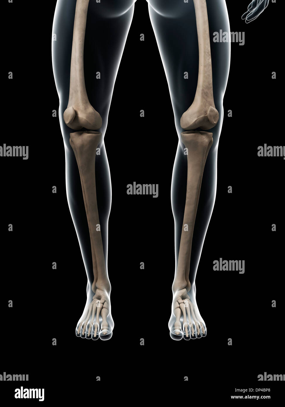 Genu Varum Banque D Image Et Photos Alamy