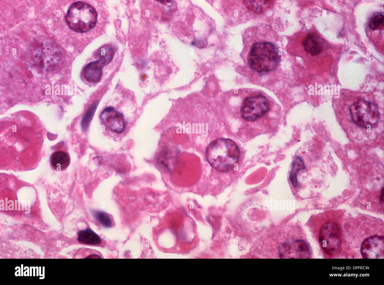Micrographie de la lumière des cellules du foie par le virus Ebola Banque D'Images