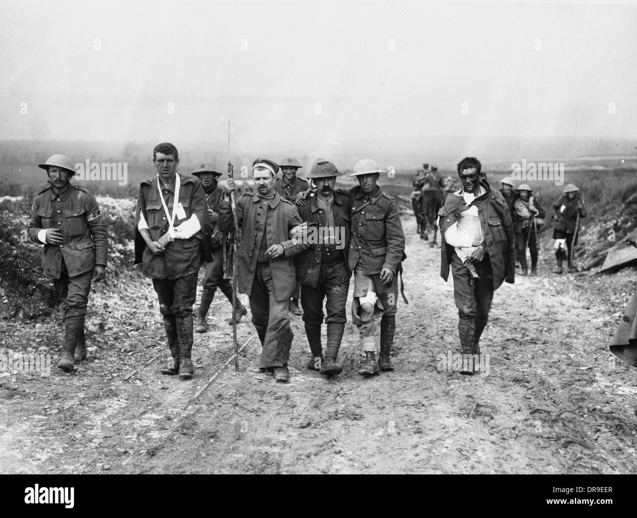 1916 blessés britanniques Banque D'Images