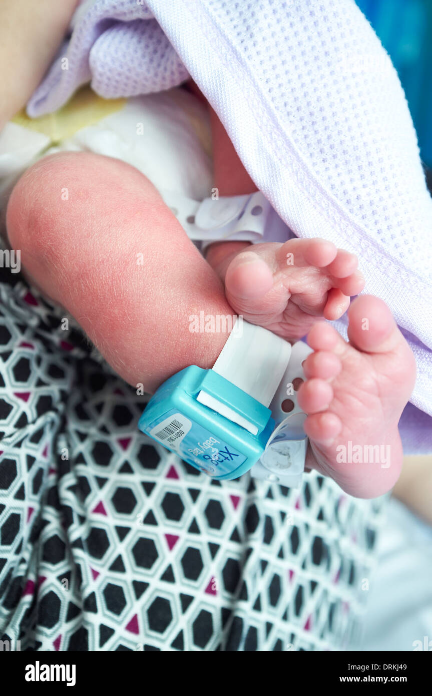 Un bébé avec une balise de sécurité pour prévenir les enlèvements de la maternité. Banque D'Images