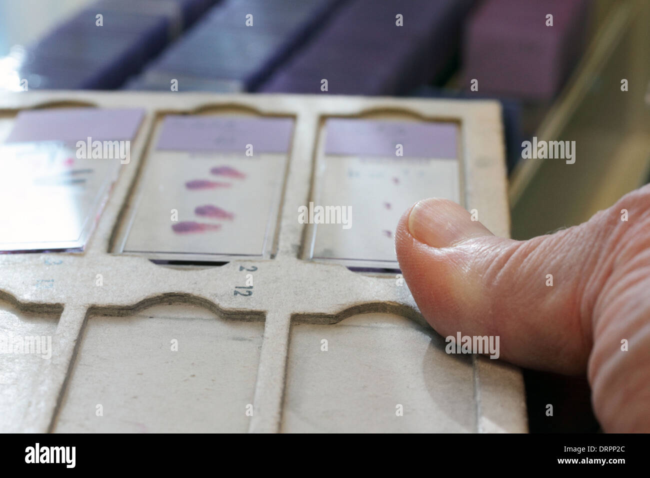 Des échantillons réels d'histologie des diapositives pour microscope à lumière de l'objet Banque D'Images