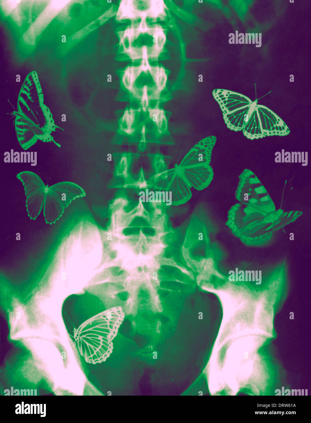 Papillons représentant le fort sentiment émotionnel de nervosité, d'amour ou d'anticipation, volant autour d'un squelette humain vert et violet brillant Banque D'Images
