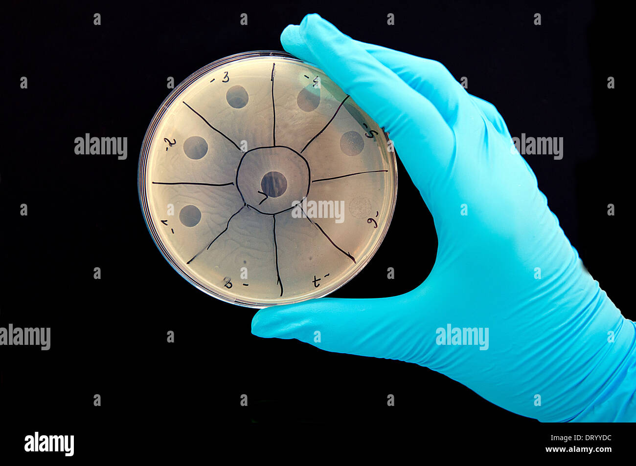 Image illustre l'activité de bactériophages. Petites taches sur la droite de la lyse des bactéries sont causés par des phages. Banque D'Images