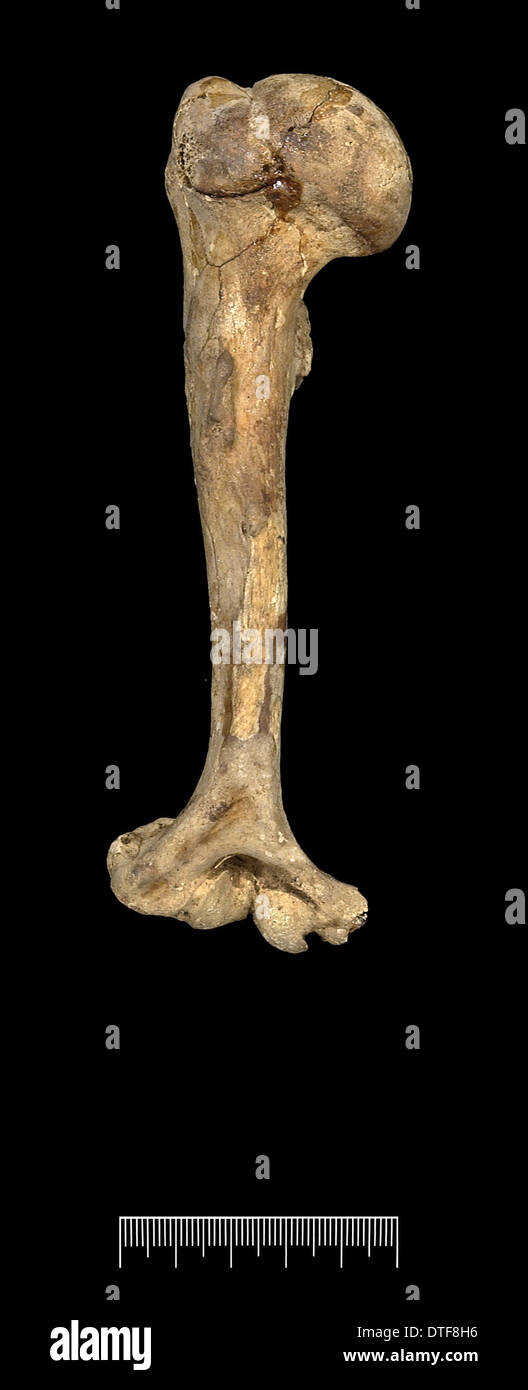 Humérus de Nain Achondroplastic Banque D'Images
