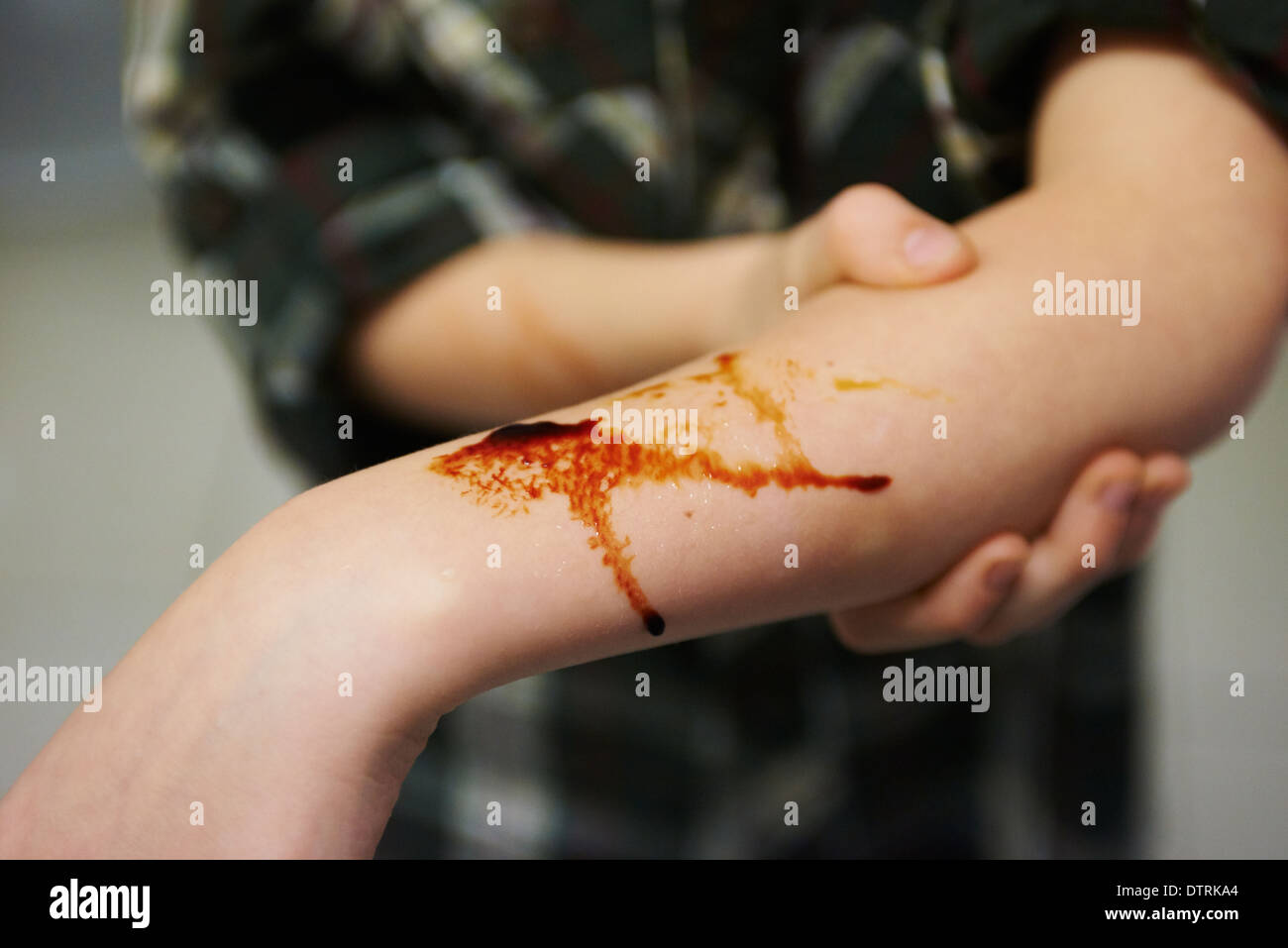 Couper la main. Garçon enfant avec le sang de sa blessure à la main coupée. Banque D'Images