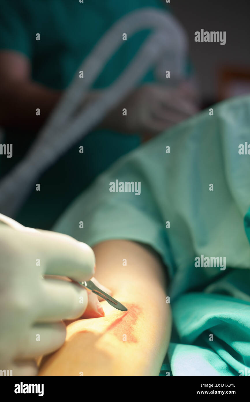 Médecin d'effectuer la chirurgie sur un bras Banque D'Images