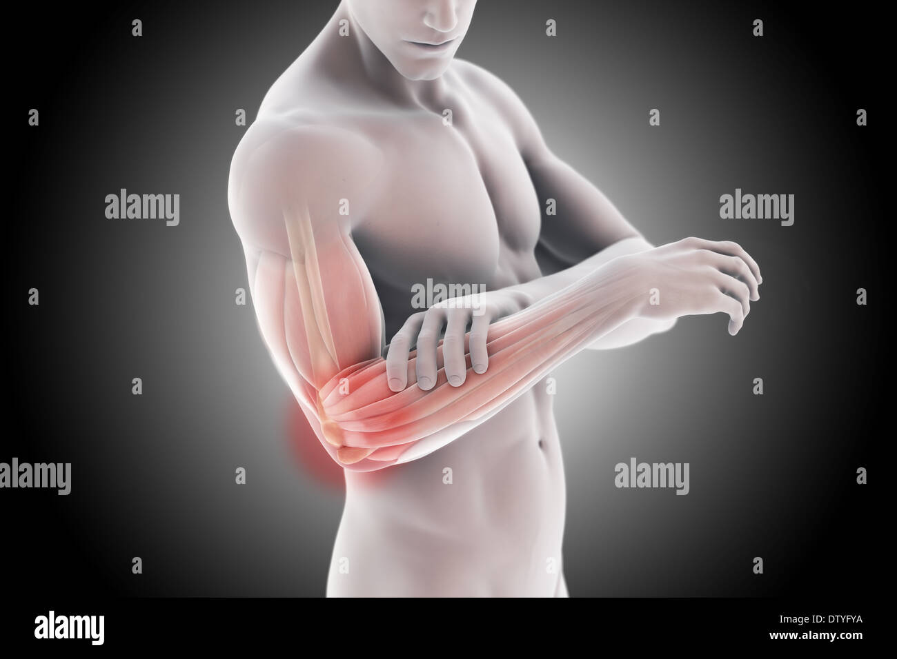 Tennis Elbow Banque D'Images