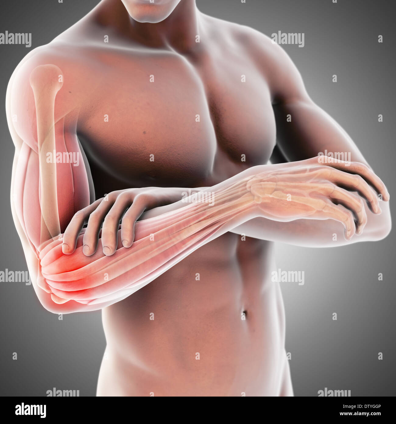 Tennis Elbow Banque D'Images