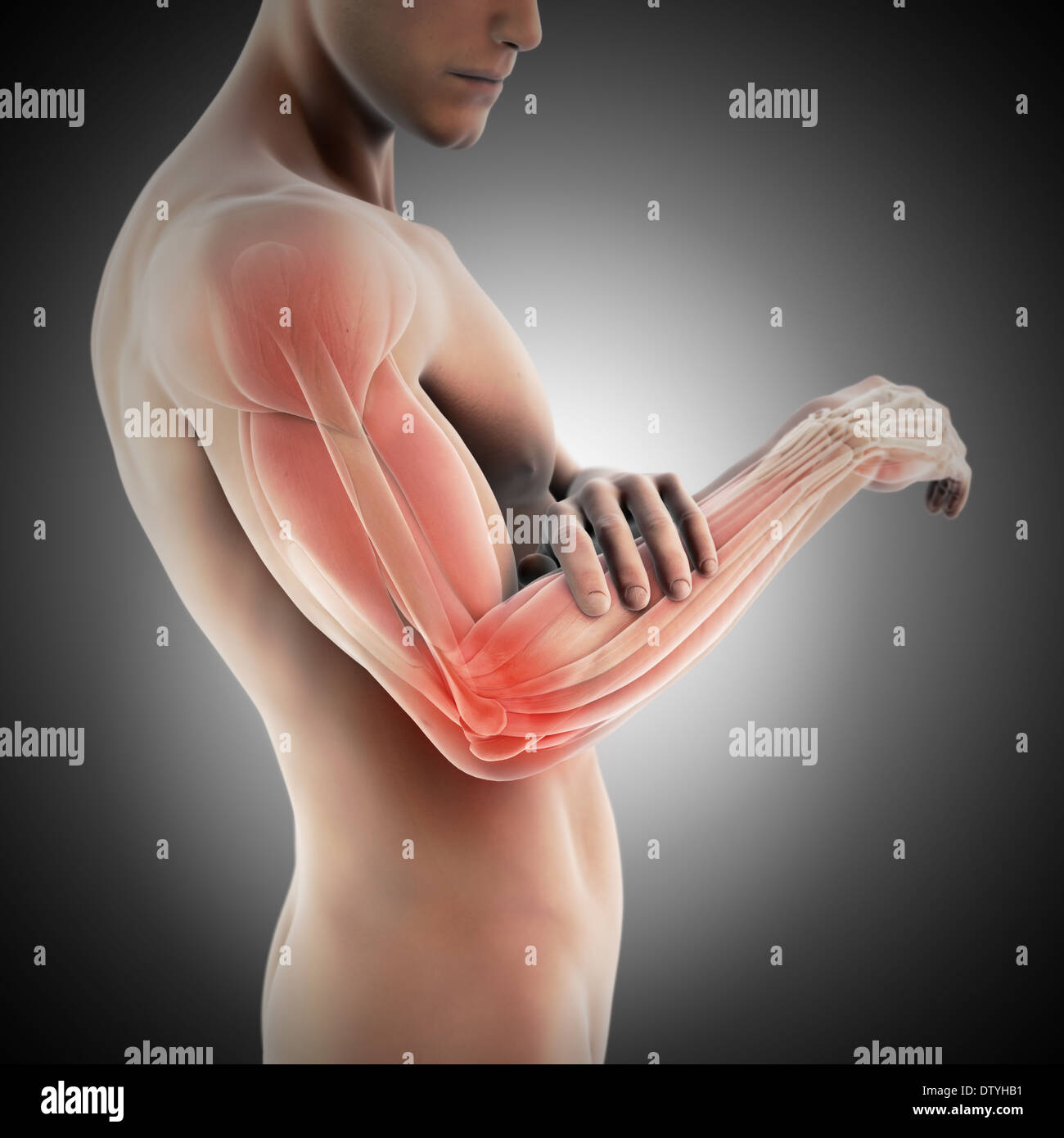 Tennis Elbow Banque D'Images