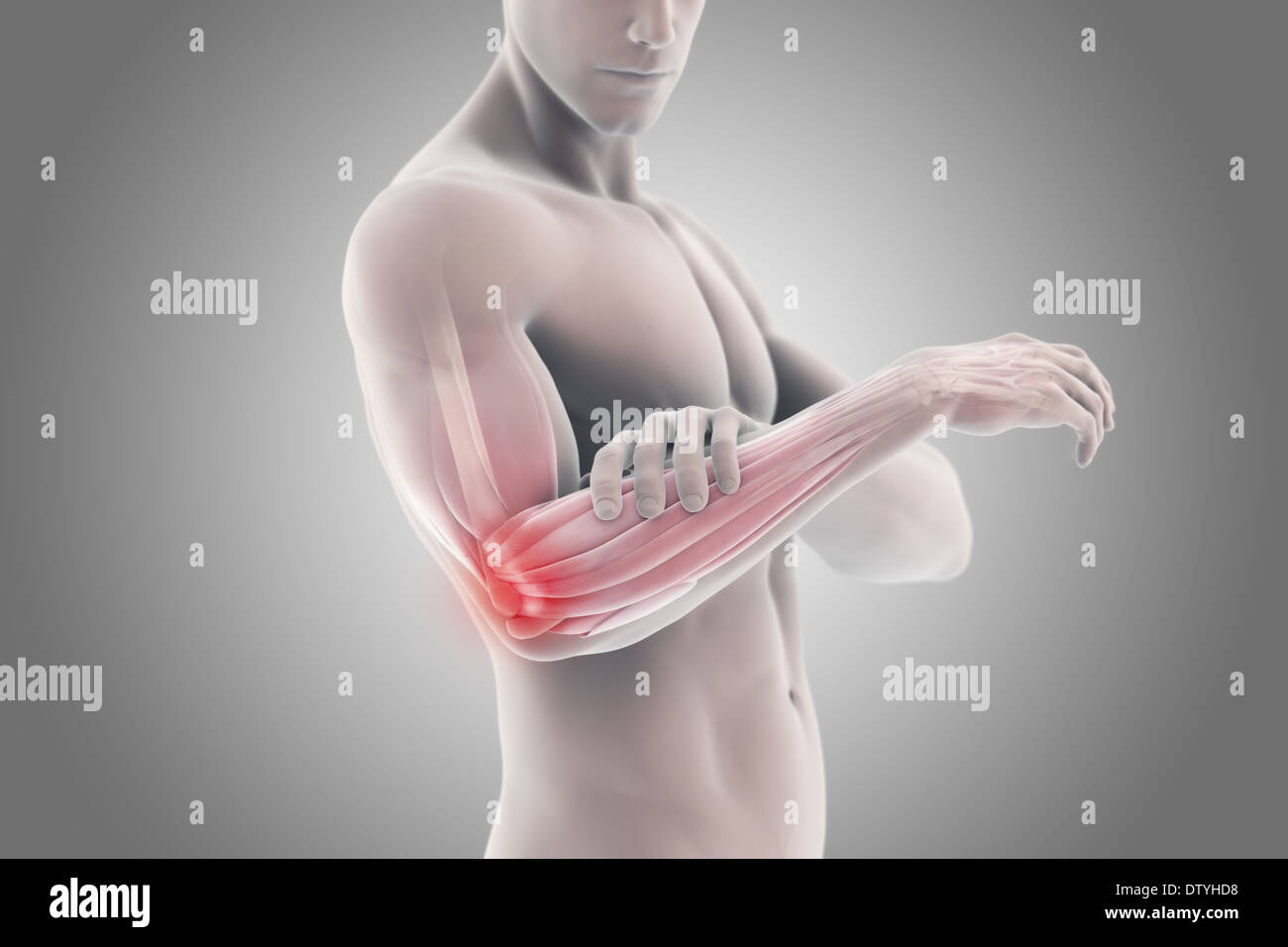 Tennis Elbow Banque D'Images