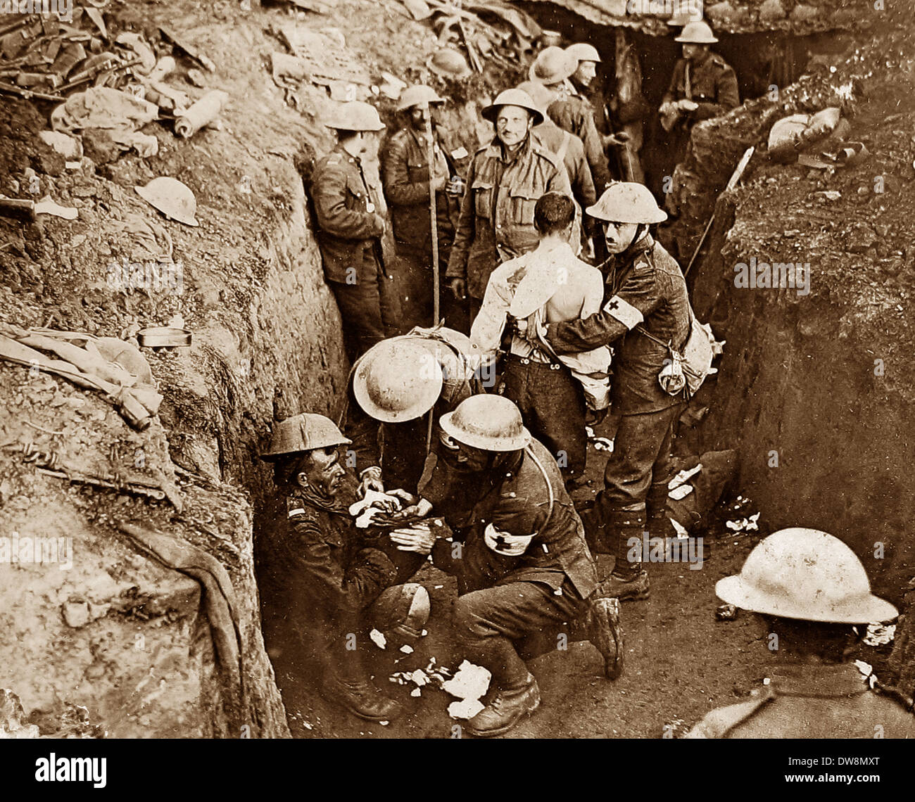 WW1 tendant soldat blessé dans une tranchée 1914 - 1918 Banque D'Images