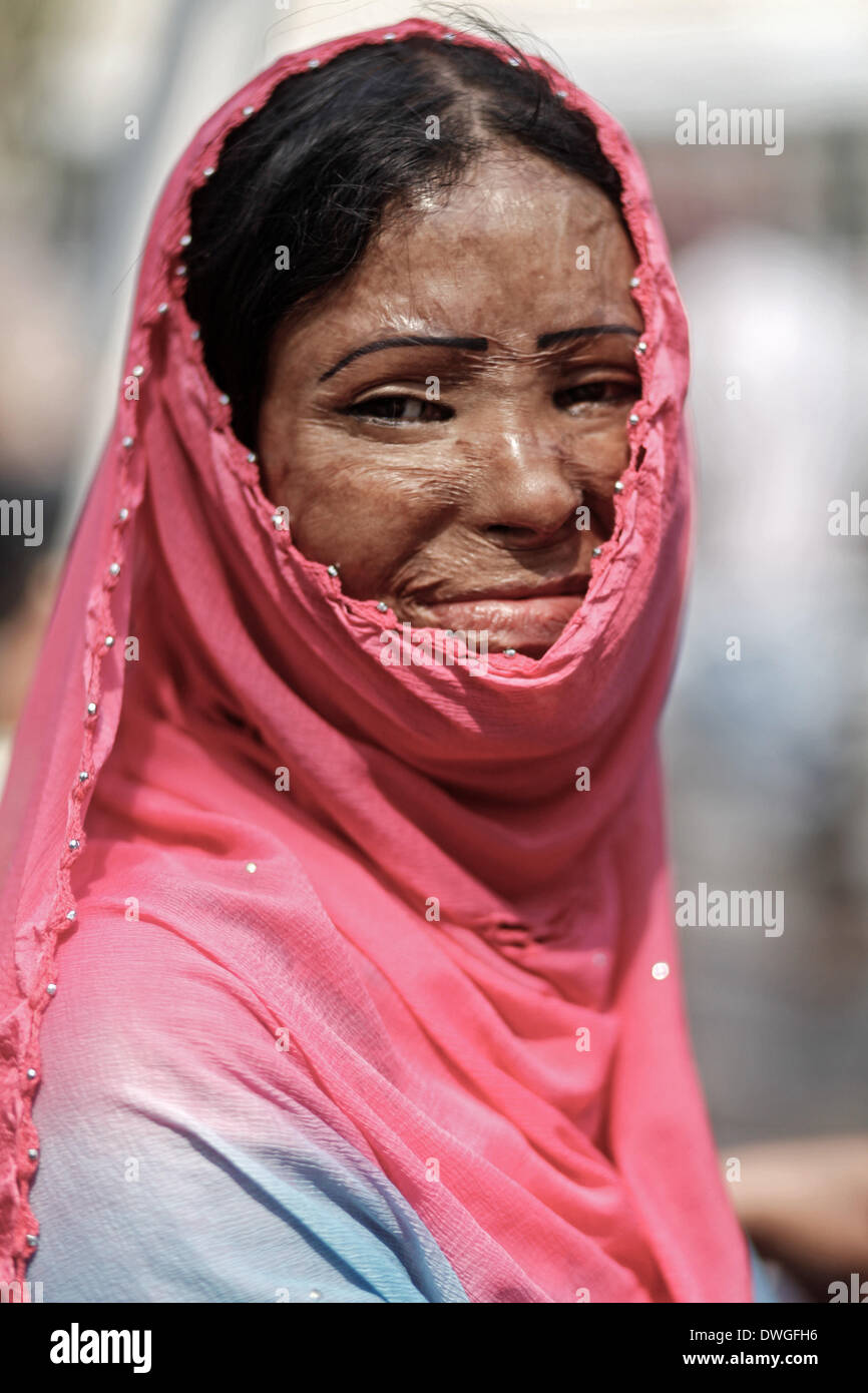 Dhaka, Bangladesh. 07Th Mar, 2014. Les survivants d'attaques à l'acide, assister à une chaîne humaine pour protester contre la violence à l'acide à la veille de la célébration de la Journée internationale de la femme, à Dhaka, au Bangladesh. Conformément à l'Acid Survivors Foundation (ASF), il y avait eu 3 184 attaques à l'acide depuis février 1999 à février 2014 au Bangladesh, où 1 792 femmes ont été victimes parmi un total de 3 512. Les attaques à l'acide sont surtout au Cambodge, au Pakistan, en Afghanistan, en Inde, au Bangladesh et à proximité d'autres pays. Credit : ZUMA Press, Inc./Alamy Live News Banque D'Images
