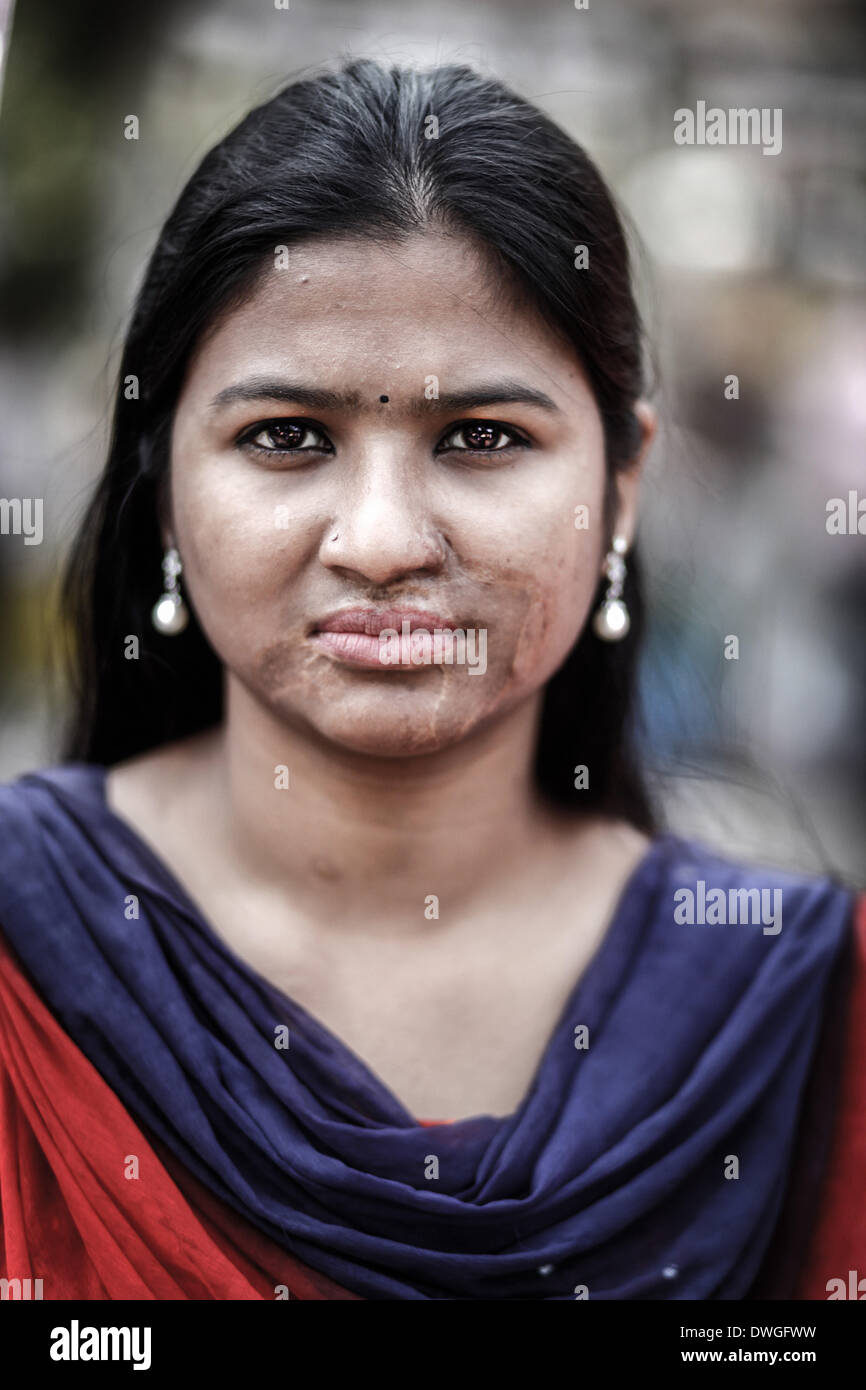 7 mars 2014 - Dhaka, Bangladesh - un survivant d'une attaque acide assiste à une chaîne humaine pour protester contre la violence à l'acide à la veille de la célébration de la Journée internationale de la femme. Conformément à l'Acid Survivors Foundation (ASF), il y avait eu 3 184 attaques à l'acide depuis février 1999 à février 2014 au Bangladesh, où 1 792 femmes ont été victimes parmi un total de 3 512. (Crédit Image : © Zakir Hossain Chowdhury/NurPhoto/ZUMAPRESS.com) Banque D'Images