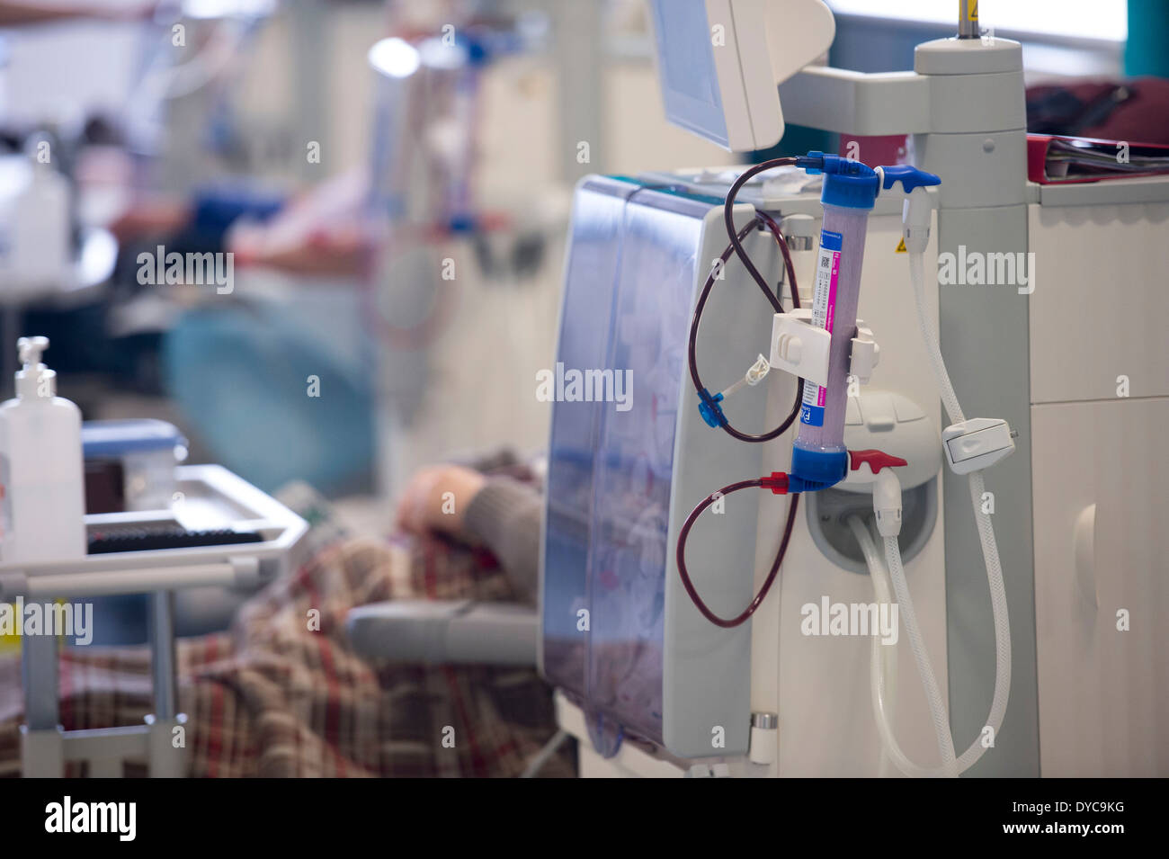 Un patient de dialyse rénale reçoit le traitement de l'insuffisance rénale dans un hôpital du NHS. Banque D'Images