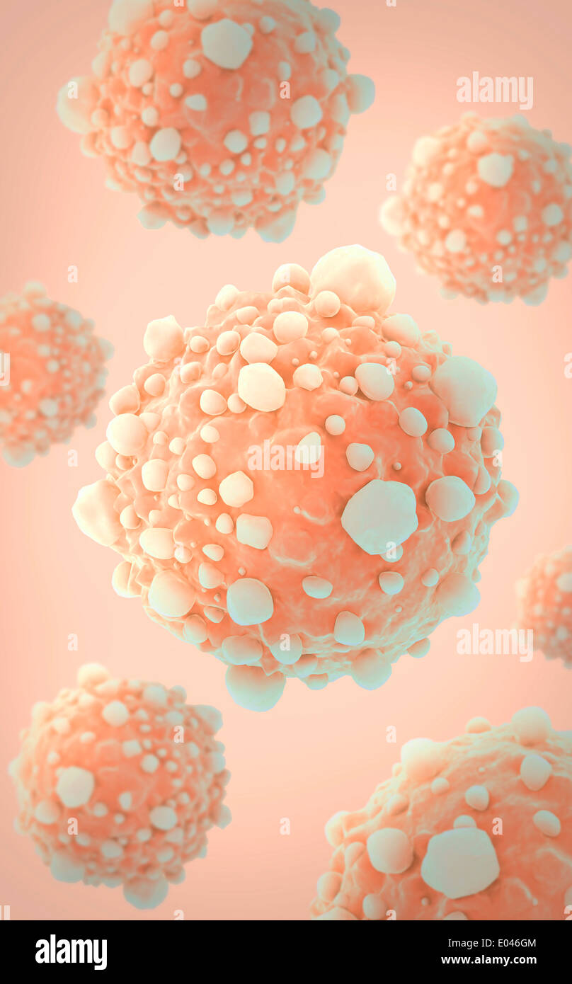 Microscipic Raison de cellules du cancer du pancréas. Banque D'Images
